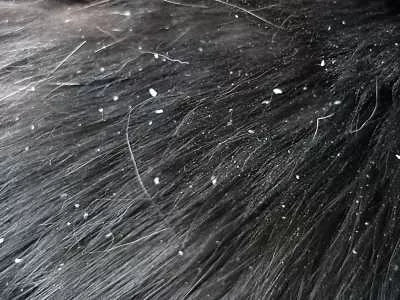 Why Does My Cat Have Dandruff