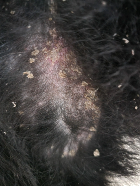 Dog Psoriasis: Causes, Symptoms, and Treatment