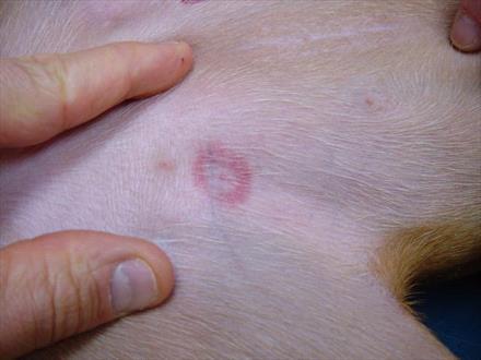 I Thought It Was Just a Bug Bite—But It Turned into a Serious Hot Spot