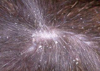 Understanding Scurf in Dogs: Causes, Treatments, and Prevention
