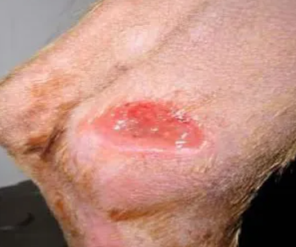 Skin Ulcer on Dog: Causes, Symptoms, and Treatment